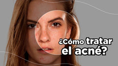 Cómo Quitar el acné