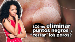 ¿Cómo Quitar los Puntos Negros de la nariz?