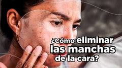 Cómo quitar Manchas de la cara