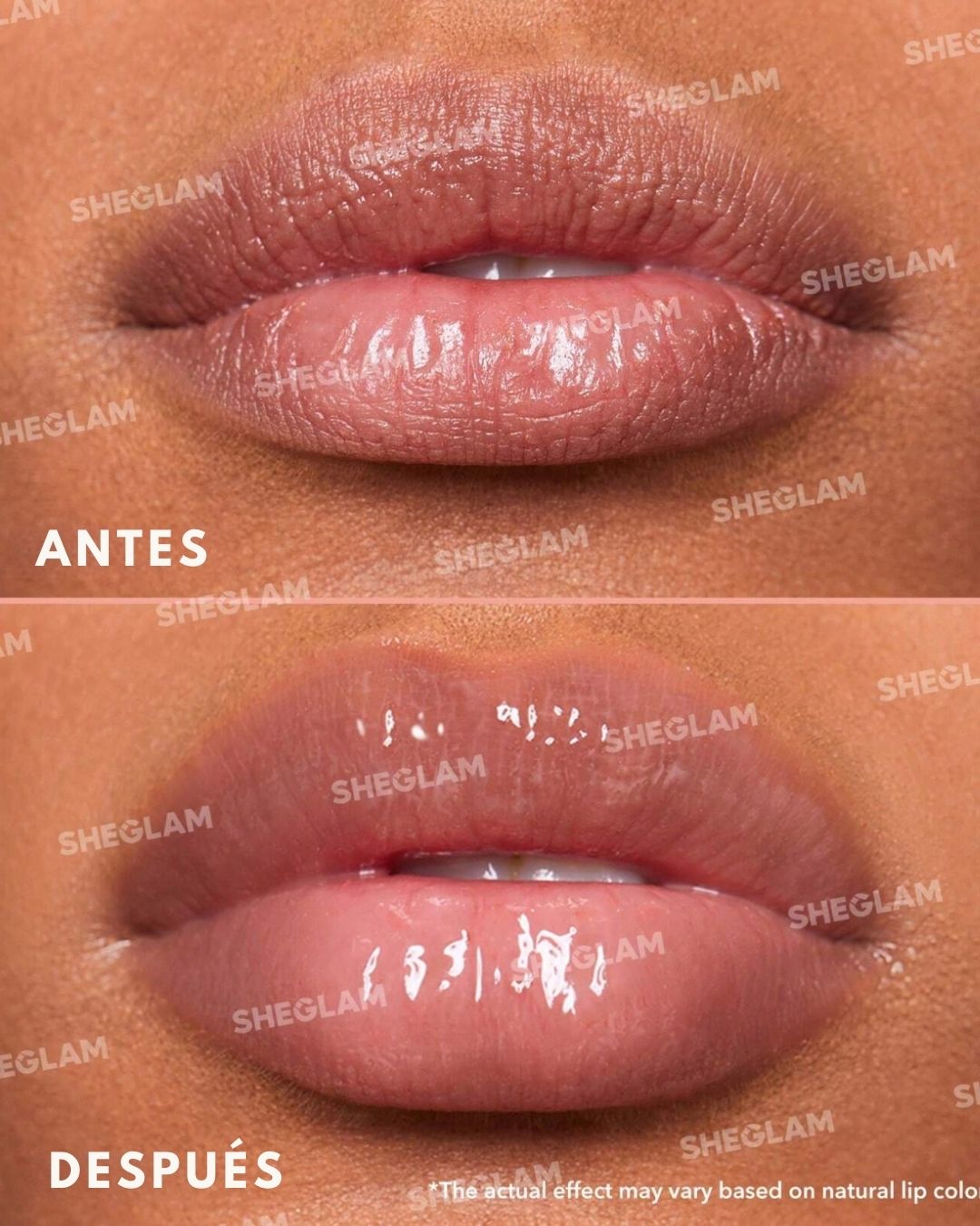 best-lip-plumper