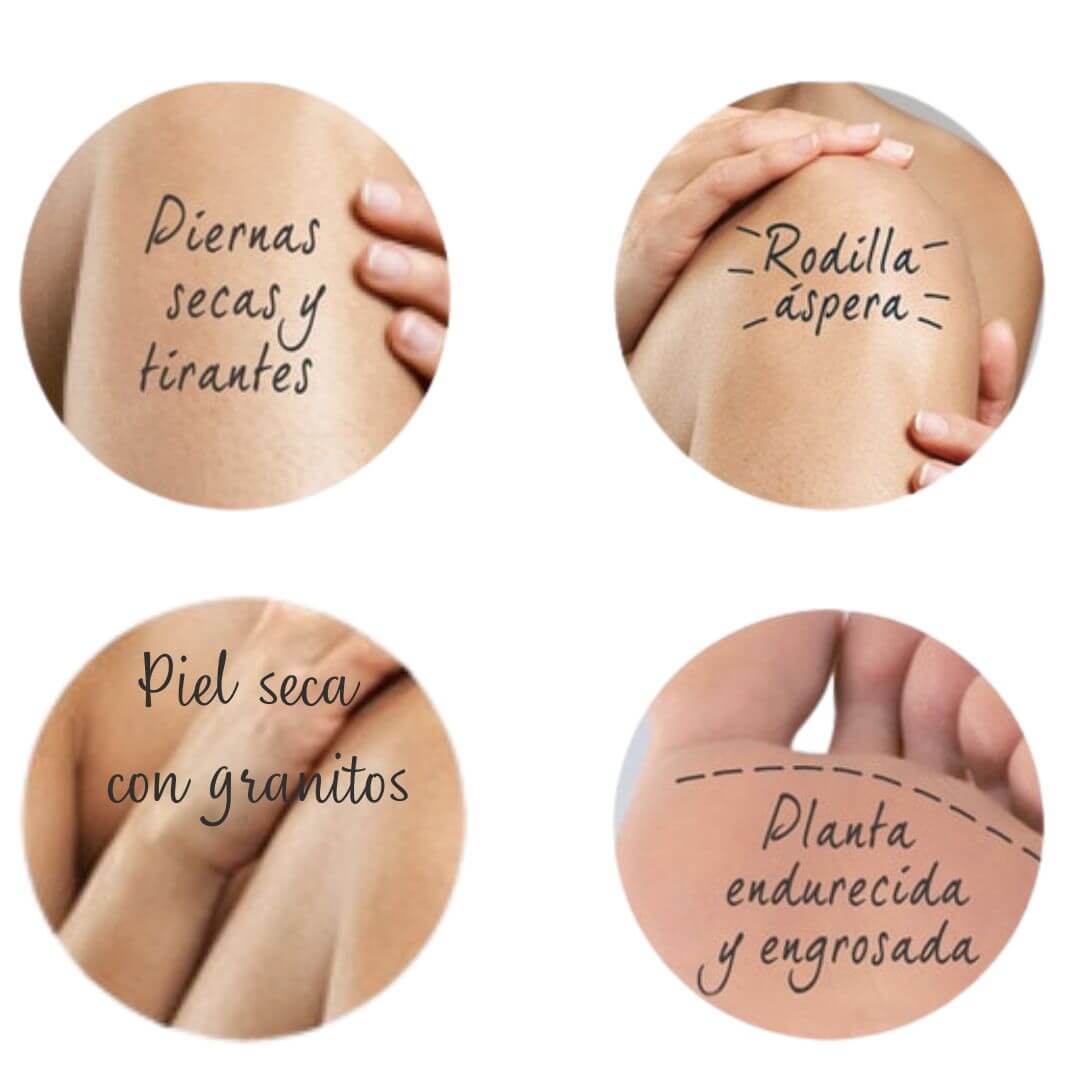     crema-con-urea-para-que-sirve